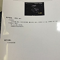 nt1.1，十三周了不太懂，应该是平安健康的对吗