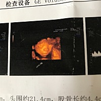 怀孕24周，昨天去做了四维B超，能看出男女吗？麻烦各位大神帮忙看看，在此谢了