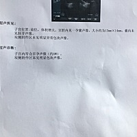 正常吗？我以为六周了B超单显示才五周