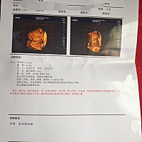 今天做的四维彩超  可以看出来是男宝还是女宝贝吗？