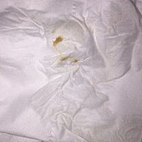 怀孕4周零几天，从10.10应该来大姨妈那天开始，一天有两三次这种淡褐色分泌物，请问大家有类似情况经验...