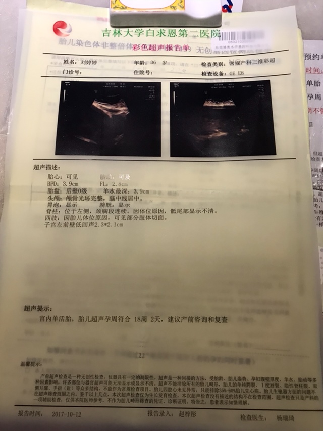 女宝宝的可能性比较大太喜欢了