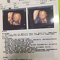 哪位经验人帮忙看看男宝女宝呢？