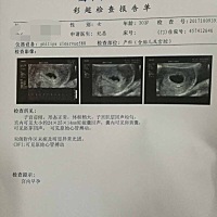 有谁知道，这个怀孕几周吗？