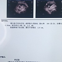 NT顺利通过，有18.4月预产期的小伙伴吗？