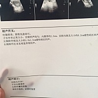 帮忙看下什么意思