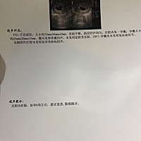 今天孕37天，天数看起来还早，可是我提前几天排卵，在我孕33天时候就已经能看到卵黄囊了，那时候HCG已经...
