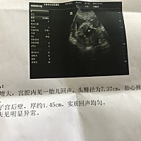 男宝还是女宝