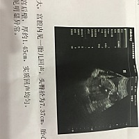 帮忙看男宝还是女宝？