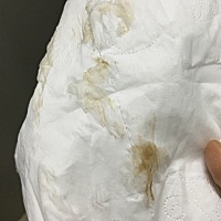 这是什么情况，明天月经日。月经前这样什么原因。