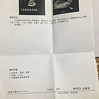 13周多，亲们能看出男女吗？