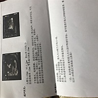 宝妈们，帮忙看看男宝还是女宝，太好奇了。十二周啦。