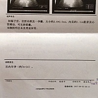 谁能看懂是女宝宝还是男宝宝