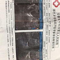 宝妈们懂得给我说一下？是不是囊肿后吓人😭。