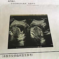 亲们，看的出男女吗？很好奇