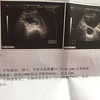 有经验的宝妈们，能帮我看看男孩女孩吗？