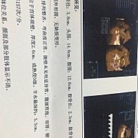 谁能看懂是男宝还是女宝的，请指点一下