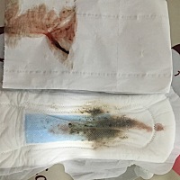 有谁知道这是什么情况。现在备孕期。