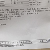 哪位有有经验的宝妈 帮忙给看看 男孩女孩呀