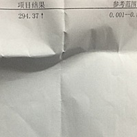 怀孕28天，正常吗