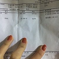 末次月经9月1674日，用保胎吗？