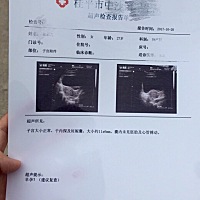 50天检查没有胎芽胎心，不懂怎么回事继续上大医院检查🙊