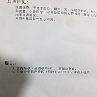 这是有心跳了嘛？，医生说积水是子宫出血是吗？