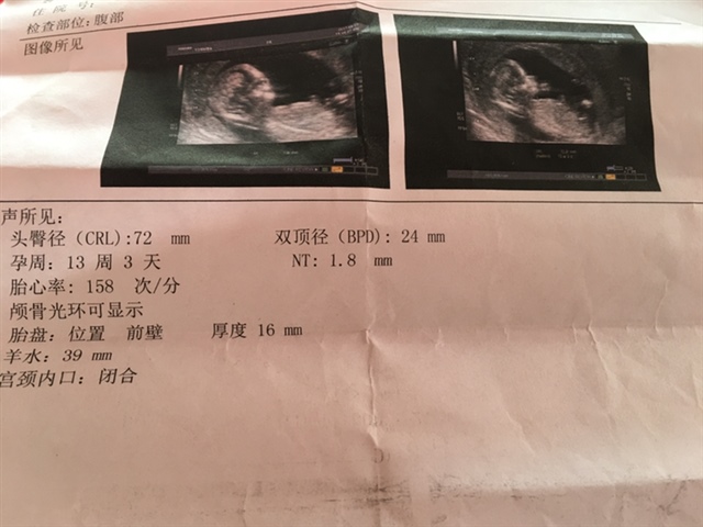 请各位有经验的宝妈帮忙看看是男宝还是女bao