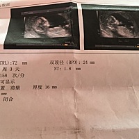 请各位有经验的宝妈帮忙看看是男宝还是女bao