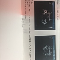 谁可以帮我看看是男宝宝还是女宝宝呢？