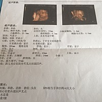 各位帮忙看下这四维彩超能看出男孩女孩吗？谢谢各位🙏
