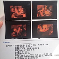 好奇男宝还是女宝 有懂的宝妈没？