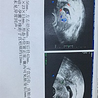 帮忙看看这数据是男孩还是女孩啊