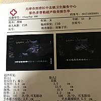 能看出来闺女小子么？