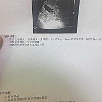 怀孕8周，需要做优生五项吗？刚刚做了B超，医生说正常，好开心