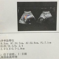 请大家给看看男女