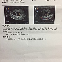 第一次去检查只照了一个b超，快9周了，还需要检查什么项目吗？