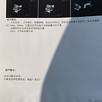 亲爱的小伙伴们，快帮我看看，有没有类似这种情况的