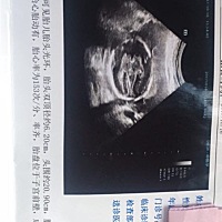 大神，五个多月了，帮看看男女