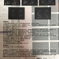 四维大排畸检查一切正常一切顺利通过