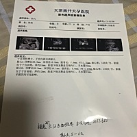 看看男孩女孩？