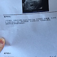 帮我看看是男宝宝还是女宝宝？