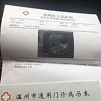 刚查好 终于看到了 放心了