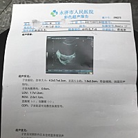 阳历9月15日例假来，10月份试纸显示两杠，今天10月26少量出血，彩超看不见孕囊，会是什么情况，没怀上会...