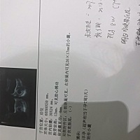 帮忙看看是男孩还是女孩😊