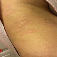 连着三个晚上了，怀孕真遭罪呀。有一样症状的朋友吗？能详细告知怎么处理最好不过了。谢谢啦。