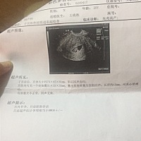 看看是男宝宝，还是女宝宝，有没有懂的