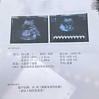 大家看看是男女呢，第一胎男女都喜欢的，就是好奇哦