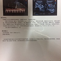 今天左腹有点阵痛，还流一些浅褐色的分泌物出来，吓得赶紧去医院，照了B超，幸好一切安好，真是有惊无险...