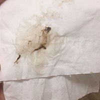 怀孕初期 留这种东西 有没有人知道是怎么回事